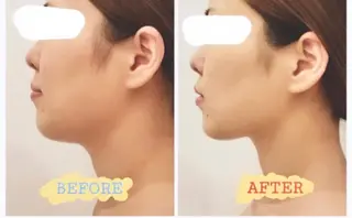 エステ ド・POLA鳥取東所属・エステド・POLA 鳥取東　YUKOのエステ・リラクイメージ