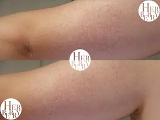 ハーブピーリング専門店HERBERRY難波心斎橋店所属・ハーブピーリング専門 HERBERRY冨永のエステ・リラクイメージ