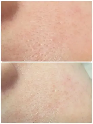 ララ/ハーブ メゾンリュバンのエステ・リラクイメージ