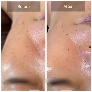 Nicore所属・Nicore NATSUKIのエステ・リラクイメージ