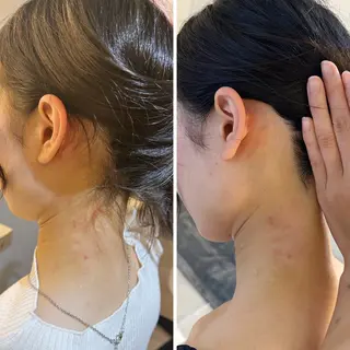 うなじ脱毛/美肌脱毛 LABELのエステ・リラクイメージ