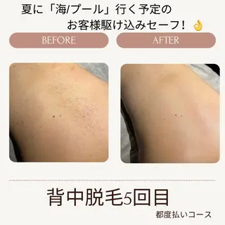 VANILLA SKY所属・VANILLA SKYのエステ・リラクイメージ