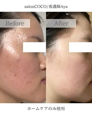 salonCOCO所属・肌管理看護師💎 salonCOCOのエステ・リラクイメージ