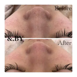 &. BYのエステ・リラクイメージ