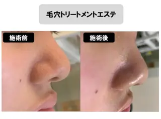 ヴィーナス ビューティーのエステ・リラクイメージ