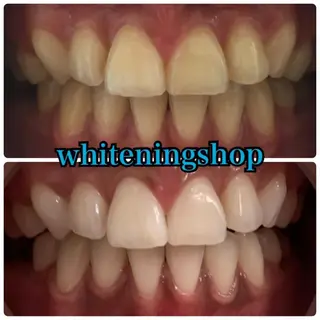 ホワイトニングショップ金沢所属・ホワイトニング ショップ金沢のその他イメージ