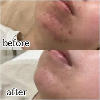 laluna saki...のその他イメージ