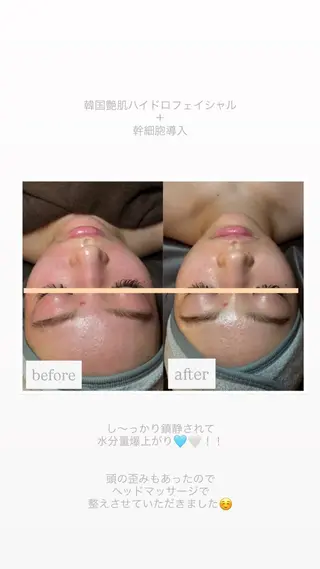 chouchou【シュシュ】所属・トータルボディケア chouchouのエステ・リラクイメージ