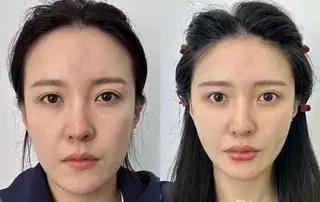 ネイル aliaハイフ&水光ジェットサロン所属・aliaハーブ水光店 エステティシャン募集のエステ・リラクイメージ