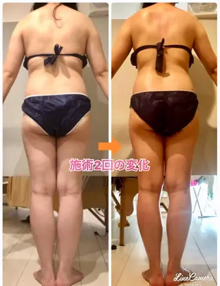 ショート カラー パーマ ヘアアレンジ メンズ キッズ ネイル マツエク・マツパ ‍痩身＆ボディ 結果出し🌟丹野のエステ・リラクイメージ