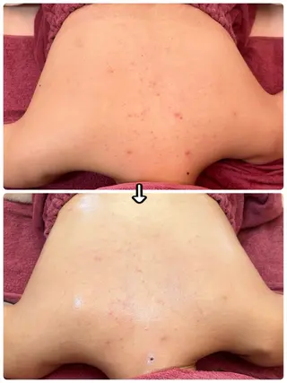 ハーブピーリングMB eautySalonのエステ・リラクイメージ