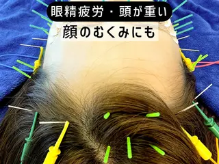 小顔美容鍼専門サロン 渋谷YZのエステ・リラクイメージ