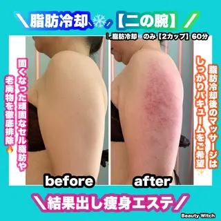 痩身/脱毛/ネイル HARUKAのエステ・リラクイメージ