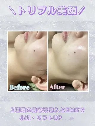 レイビス盛岡店 ♡吉田♡のエステ・リラクイメージ