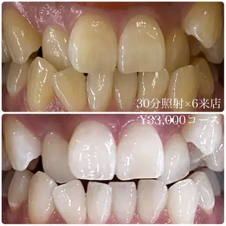 メンズ ホワイトニングルーム　川崎店所属・ホワイトニング ルーム　川崎店のその他イメージ