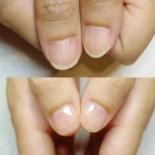 ネイル 深爪矯正/爪育成ケア manie nailのネイルデザイン
