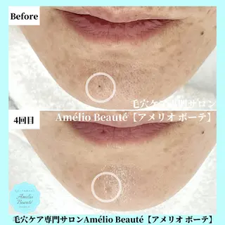 毛穴ケア専門サロン Amélio Beauté所属・毛穴ケア専門サロン アメリオボーテのその他イメージ
