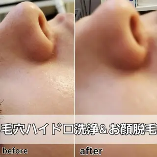 メンズ 小顔・美肌ケア専門 Diva北浜のエステ・リラクイメージ