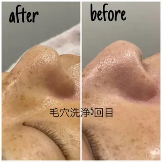 毛穴洗浄・痩身・脱毛 /アルカンジュのエステ・リラクイメージ