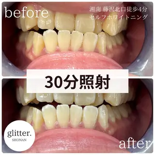 glitter.SHONAN所属・佐久間 茉弥のエステ・リラクイメージ