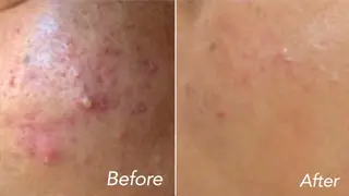 L’Beige レベージュのエステ・リラクイメージ