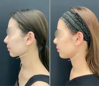 マツエク・マツパ aliaハイフ&水光ジェットサロン所属・aliaハーブ水光店 エステティシャン募集のエステ・リラクイメージ