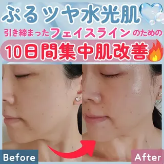 痩身ハーブピーリング 筋膜リリース☆B&Hのエステ・リラクイメージ