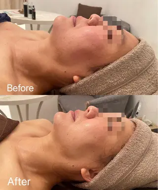 Remina clinical salon所属・ハイフ美肌専門 Remina.c.sのエステ・リラクイメージ