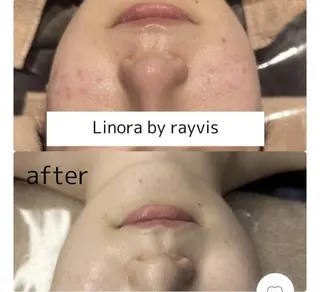 👑Linolaby RAYVIS👑🌼のエステ・リラクイメージ