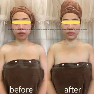 aliaハイフ&水光ジェットサロン所属・aliaハーブ水光店 エステティシャン募集のエステ・リラクイメージ