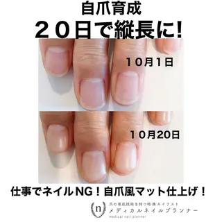 ネイル NAIL SALON ｔｏｇｇｙのネイルデザイン
