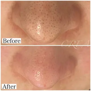 CREA【クレア】 川中のエステ・リラクイメージ