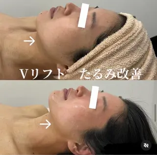 ブライダル痩身×脱毛 尼崎駅前サロンのエステ・リラクイメージ