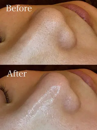 EARTH coiffure beaute 新潟紫竹山店所属・🤍アベシュリ /フェイシャル🤍のエステ・リラクイメージ