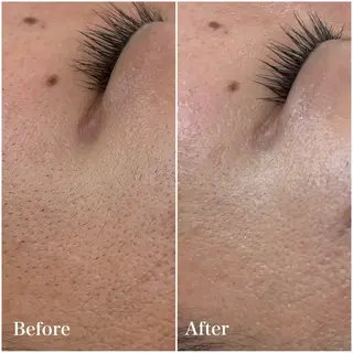 美肌育成専門サロンラクシュミー所属・毛穴肌管理サロン ラクシュミーのエステ・リラクイメージ