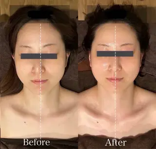 Linoas所属・kogao&head Linoasのエステ・リラクイメージ