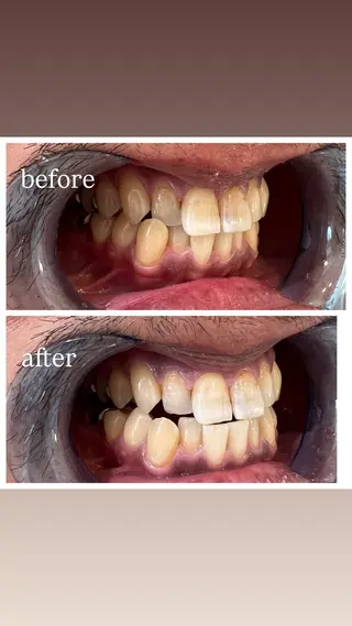 セルフホワイトニング Shineeのエステ・リラクイメージ