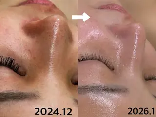 aroma  YURARI所属・韓国艶美人// 毛穴ケア🌹のエステ・リラクイメージ