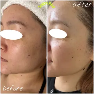 Salon.Rire サロン リルのエステ・リラクイメージ