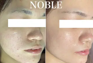 NOBLE 新宿南口店のエステ・リラクイメージ