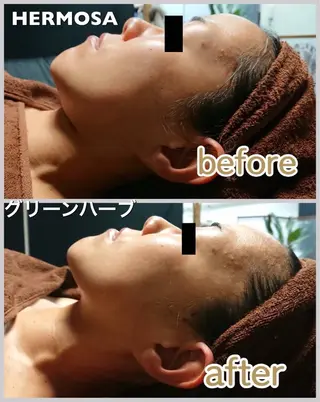 オールハンド フェイシャルのエステ・リラクイメージ