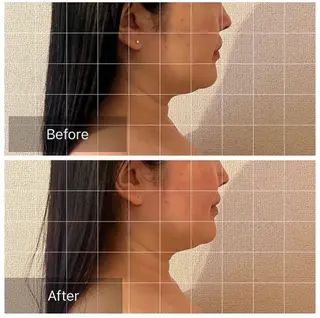 表情筋フェイシャル 三軒茶屋のエステ・リラクイメージ