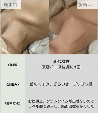 脱毛・眉毛・フェイス サロンN久留米店の眉毛・アイブロウイメージ