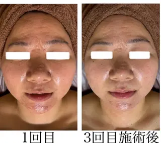 ネイル&エステ phuan(プアン)のネイルデザイン