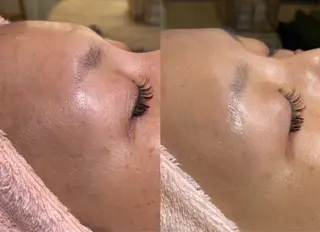 BLOOMi.(CARRIE NAIL内)所属・肌悩み専門店 BLOOMi.のエステ・リラクイメージ