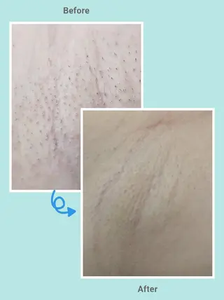 プライベートサロンマリン所属・Private Sa lon MARINEのエステ・リラクイメージ