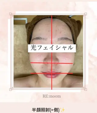 RE:moom リムーム/脱毛エステのエステ・リラクイメージ