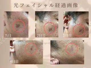 山崎 陽子のエステ・リラクイメージ