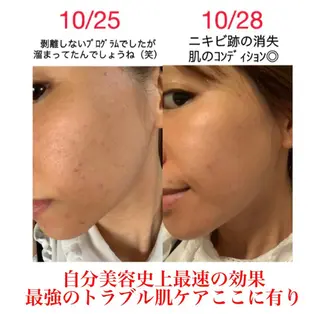 a  room salonのエステ・リラクイメージ