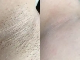 Hit. シュガーリング豊橋のエステ・リラクイメージ